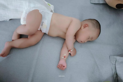 诸暨宝宝头上长痱子